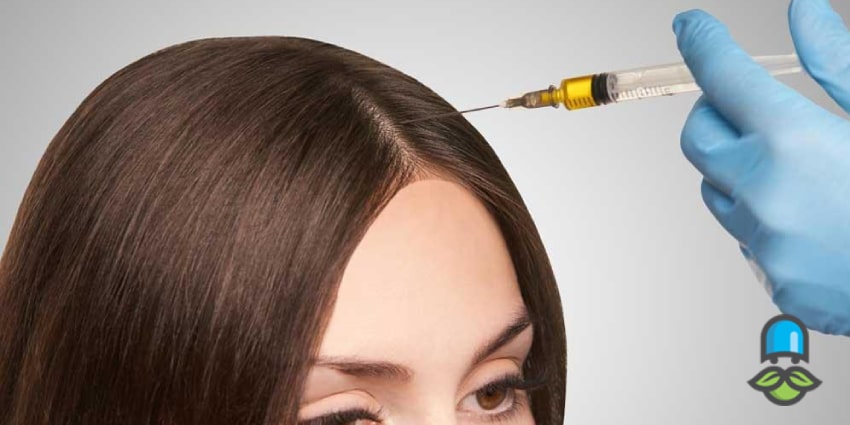 پی آر پی مو چیست و چگونه به موهای شما کمک میکند؟